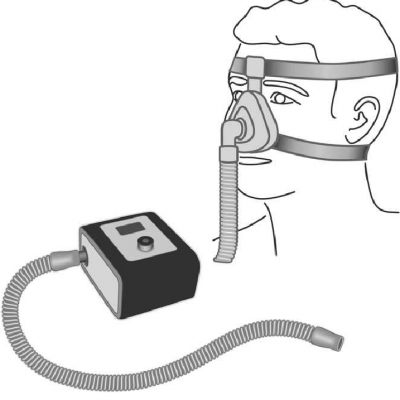 Continuous positive airway pressure (CPAP)